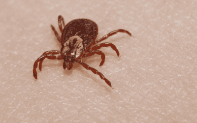 What To Do After A Tick Bite